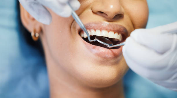 Best Emergency Dentist for Lost Fillings or Crowns in Plainwell, MI